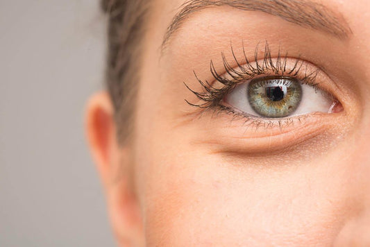 Why Do Your Under Eyes Get Dark?
