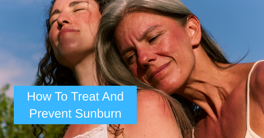 How to Treat and Prevent Sunburn: Expert-Approved Skincare Remedies for Soothing Summer Skin